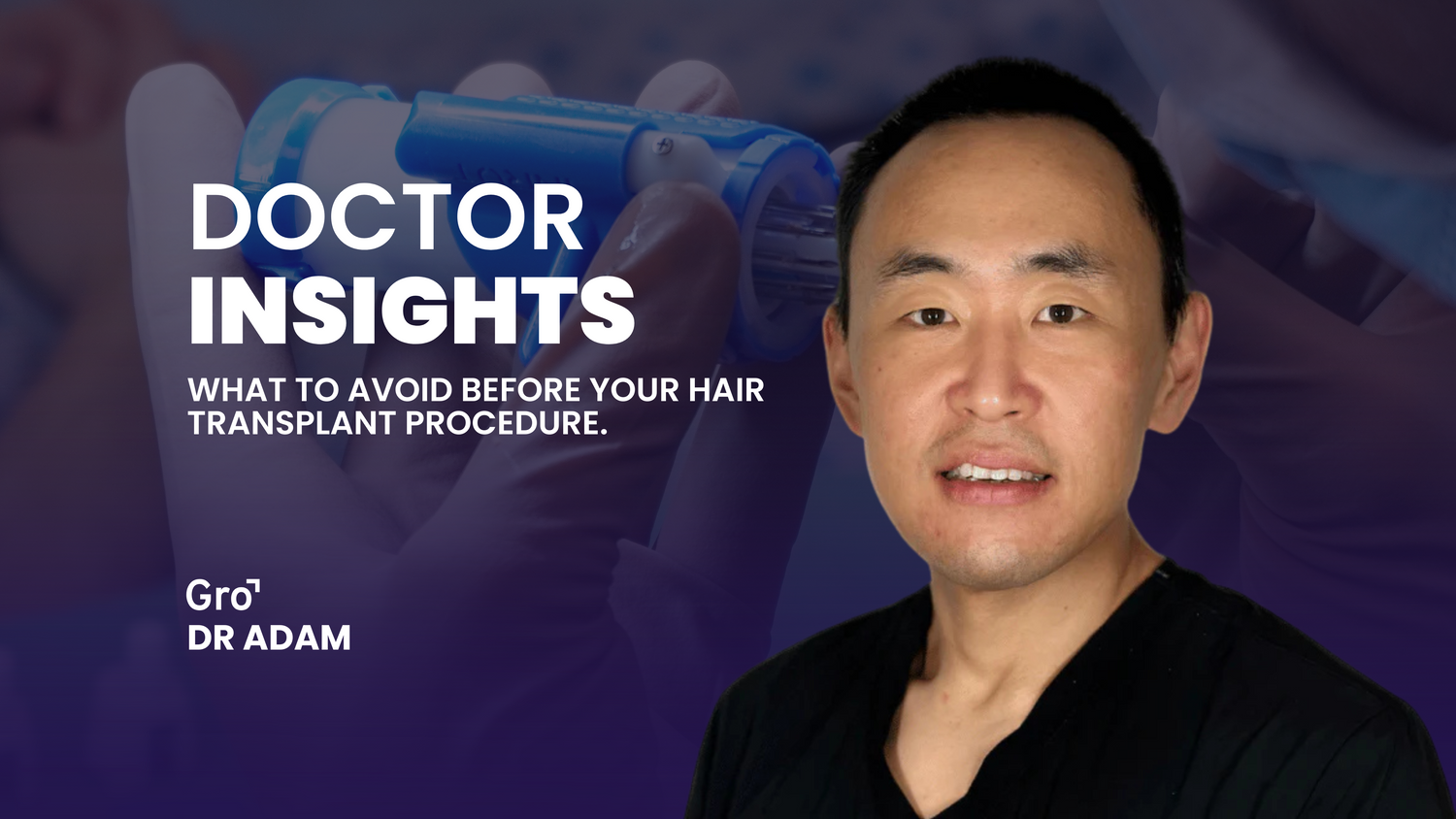 What to Avoid Before Your Hair Transplant Procedure