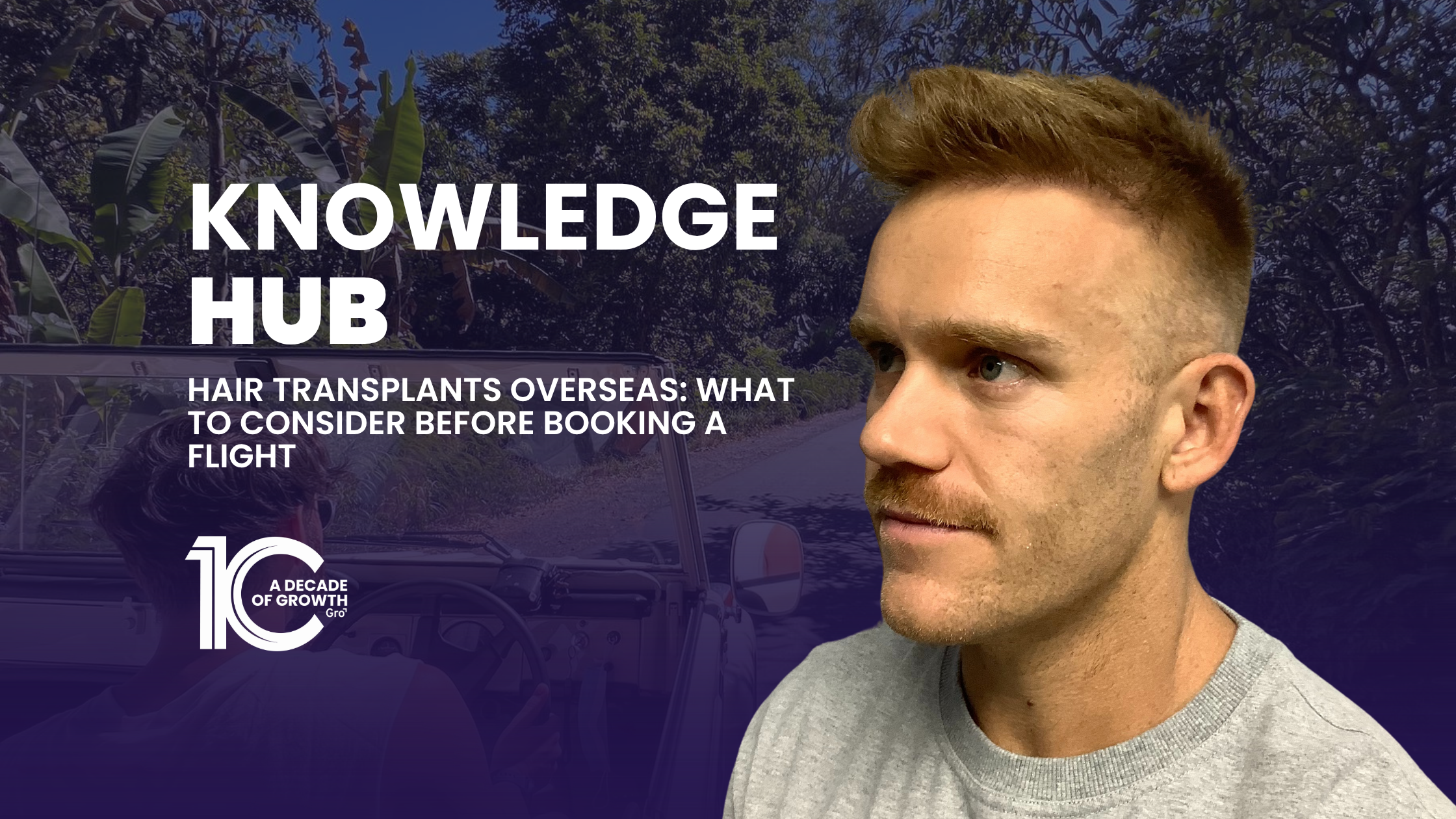 Hair Transplants Overseas: What to Consider Before Booking a Flight