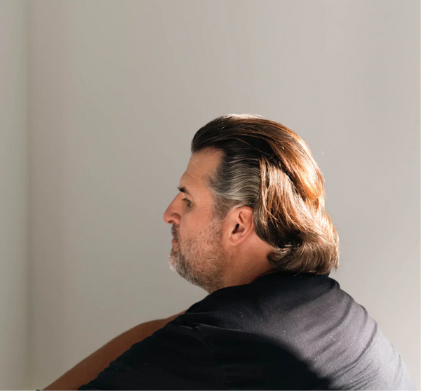 Mature Hairline vs Receding Hairline: Signs, Stages & Treatment