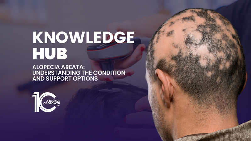 Alopecia Areata: Understanding the Condition and Support Options