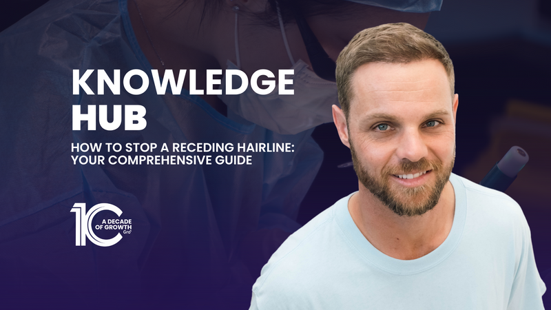 How to Stop a Receding Hairline: Your Comprehensive Guide