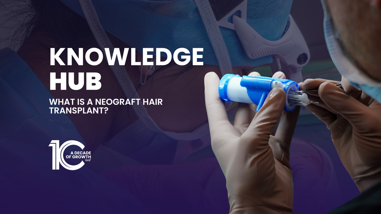 What Is a NeoGraft Hair Transplant?