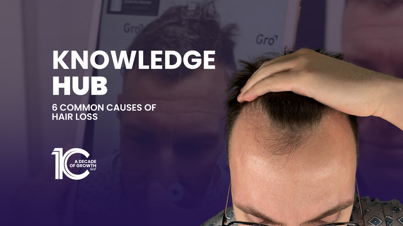 6 Common Causes of Hair Loss