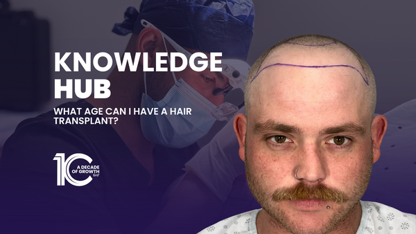 What Age Can I Have a Hair Transplant?