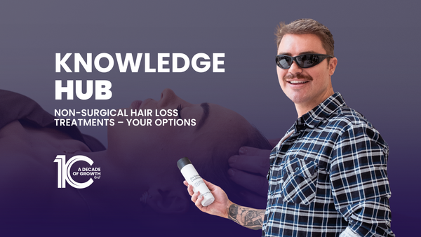 Non-Surgical Hair Loss Treatments – Your Options