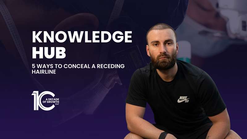 5 Ways to Conceal a Receding Hairline