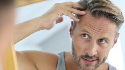 Hair Loss: Understanding Alopecia