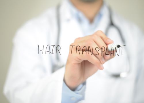 What It’s Like To Have A Hair Transplant – Jonathan’s Journey