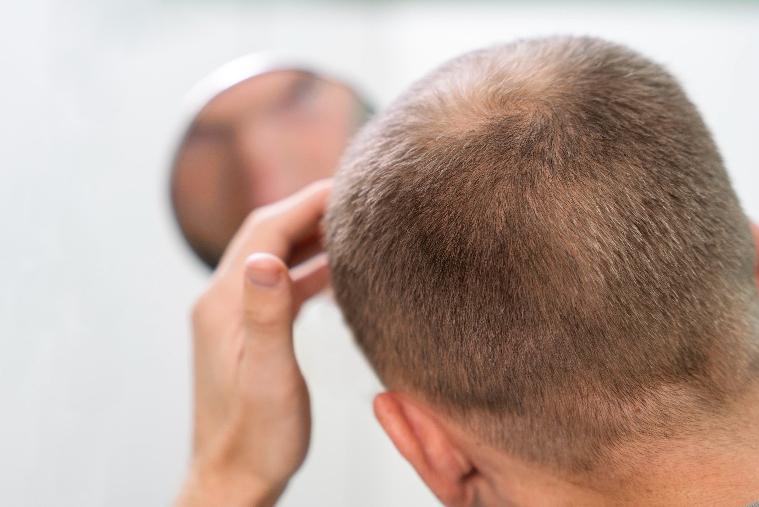 Hair Loss 101: Why is My Hair Falling Out?