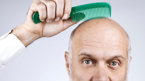 Top Tips For Hair Loss Prevention