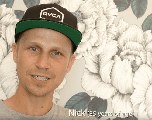 Nick’s Hair Transplant Before & After Videos
