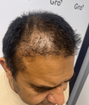 Before image for Prashaan
