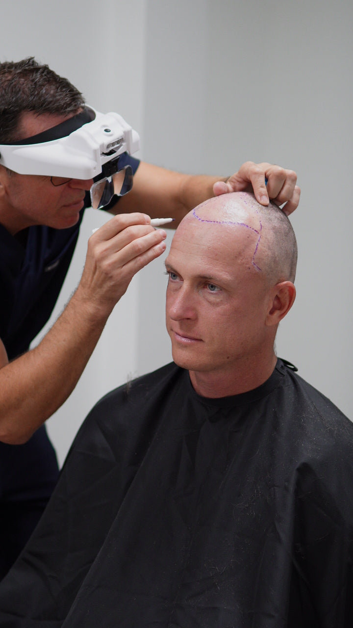 Designing a Hairline That Lasts