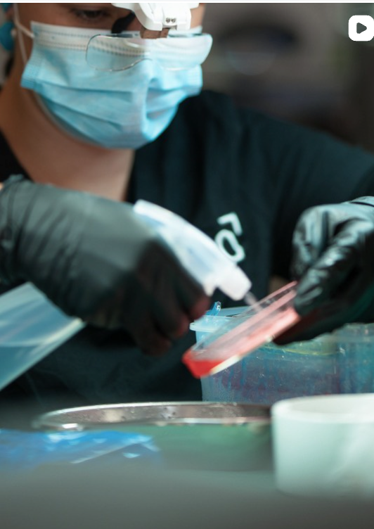 What Does a Hair Transplant Feel Like?