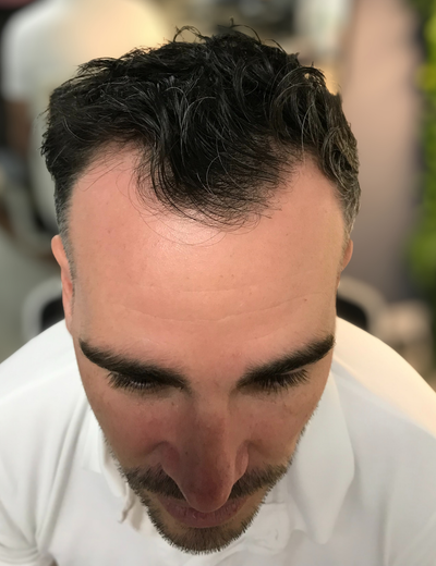 Before image for 
