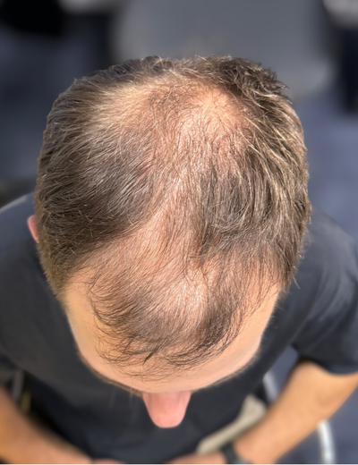 Before image for 