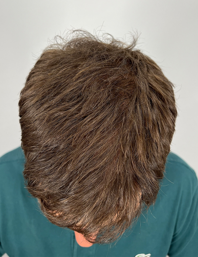 After image for 