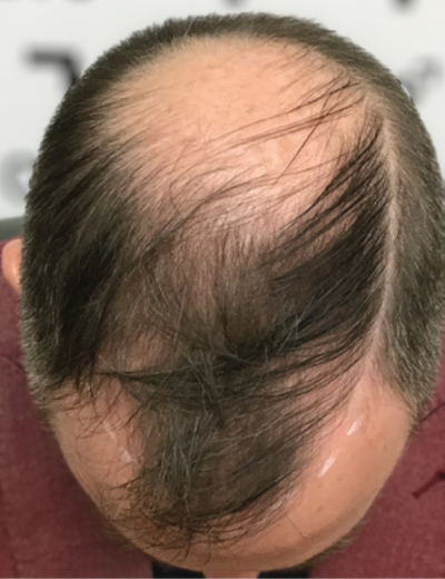 Before image for 