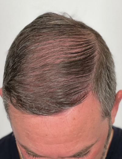 After image for 