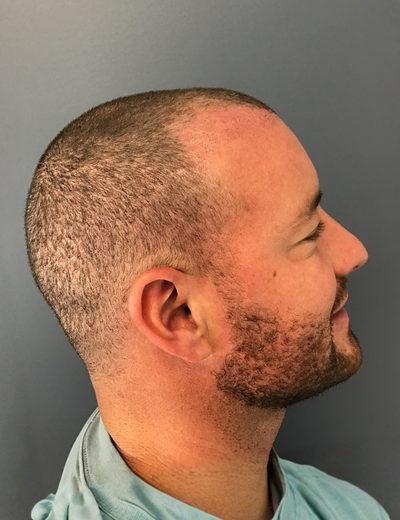 Before image for 