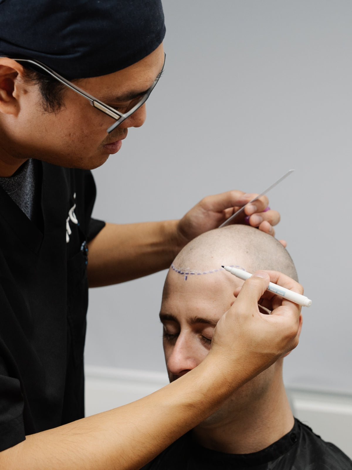 Considering factors contributing to the cost of a hair transplant include donor area's viability and other variables that play a part in what's realistically achievable.