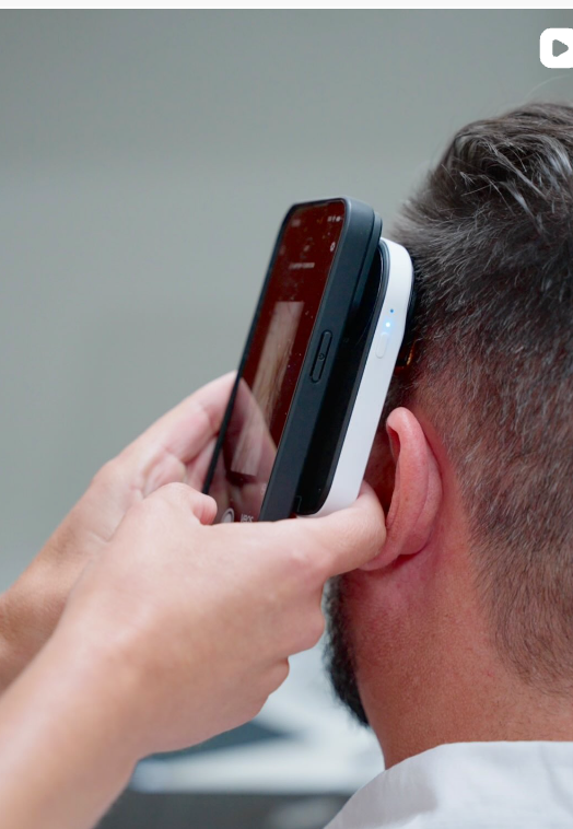 Common Hair Loss Myths, Debunked