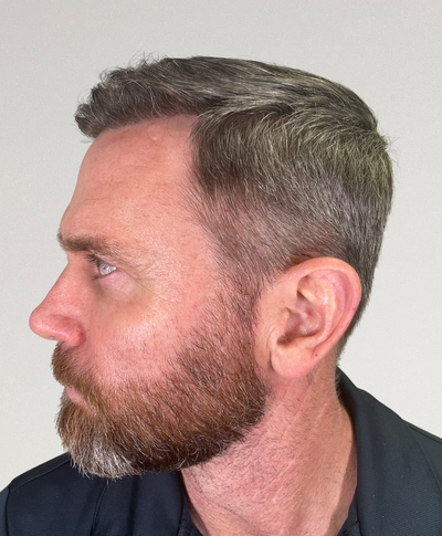 After image for David