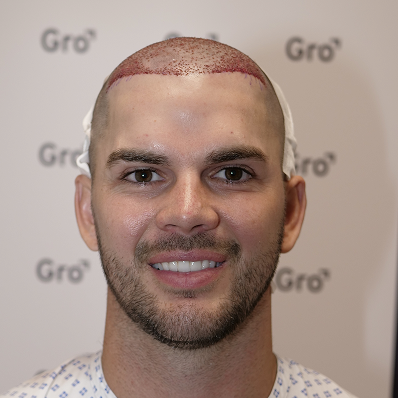 Gro Prescription Haircare