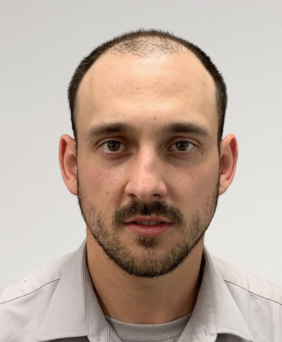 Before image for Matt