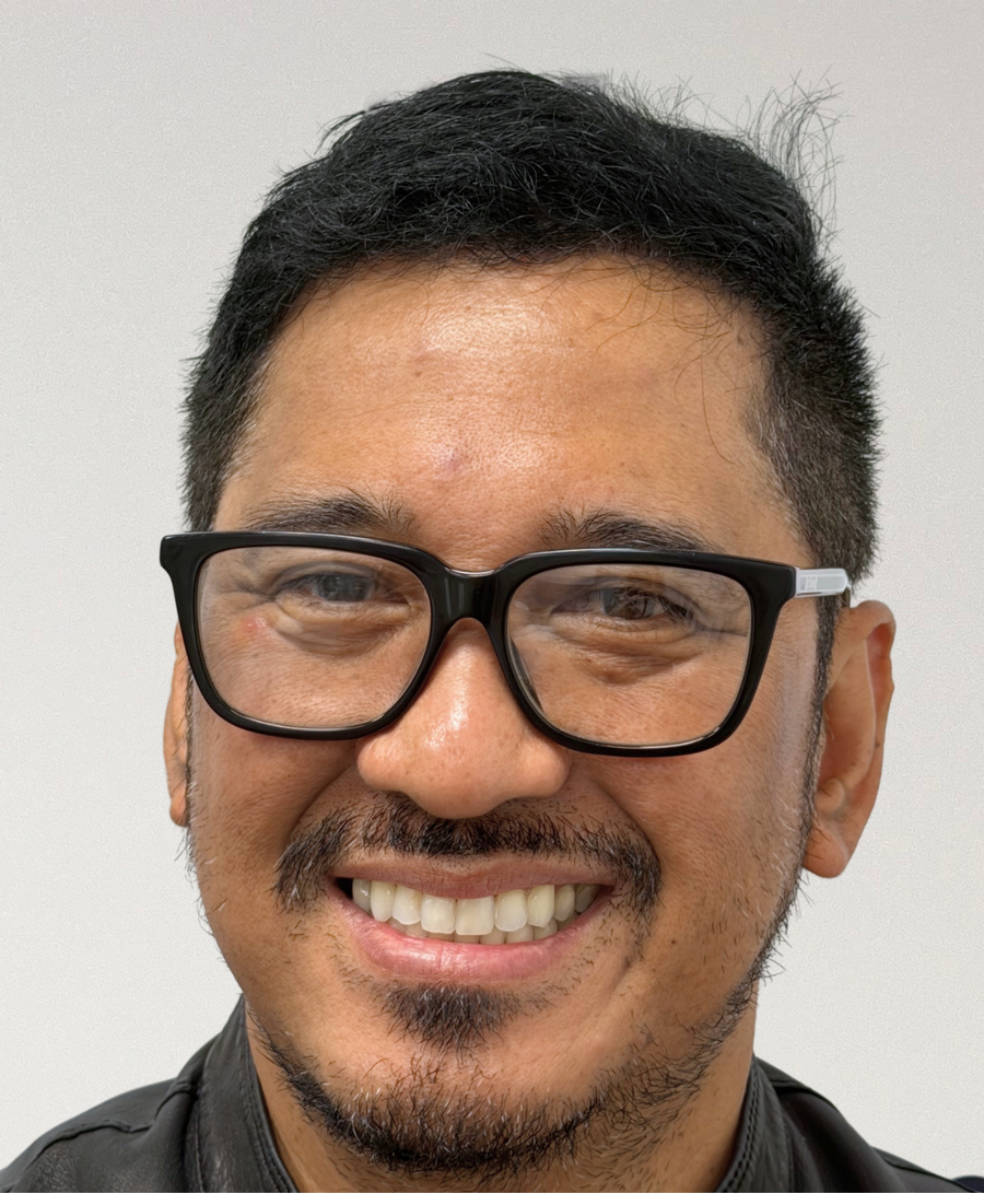 The same patient 6 months, treated by Dr Kristy Truong