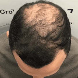 Before image for Andy