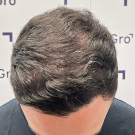 After image for Andy