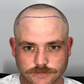 Before image for Jackson