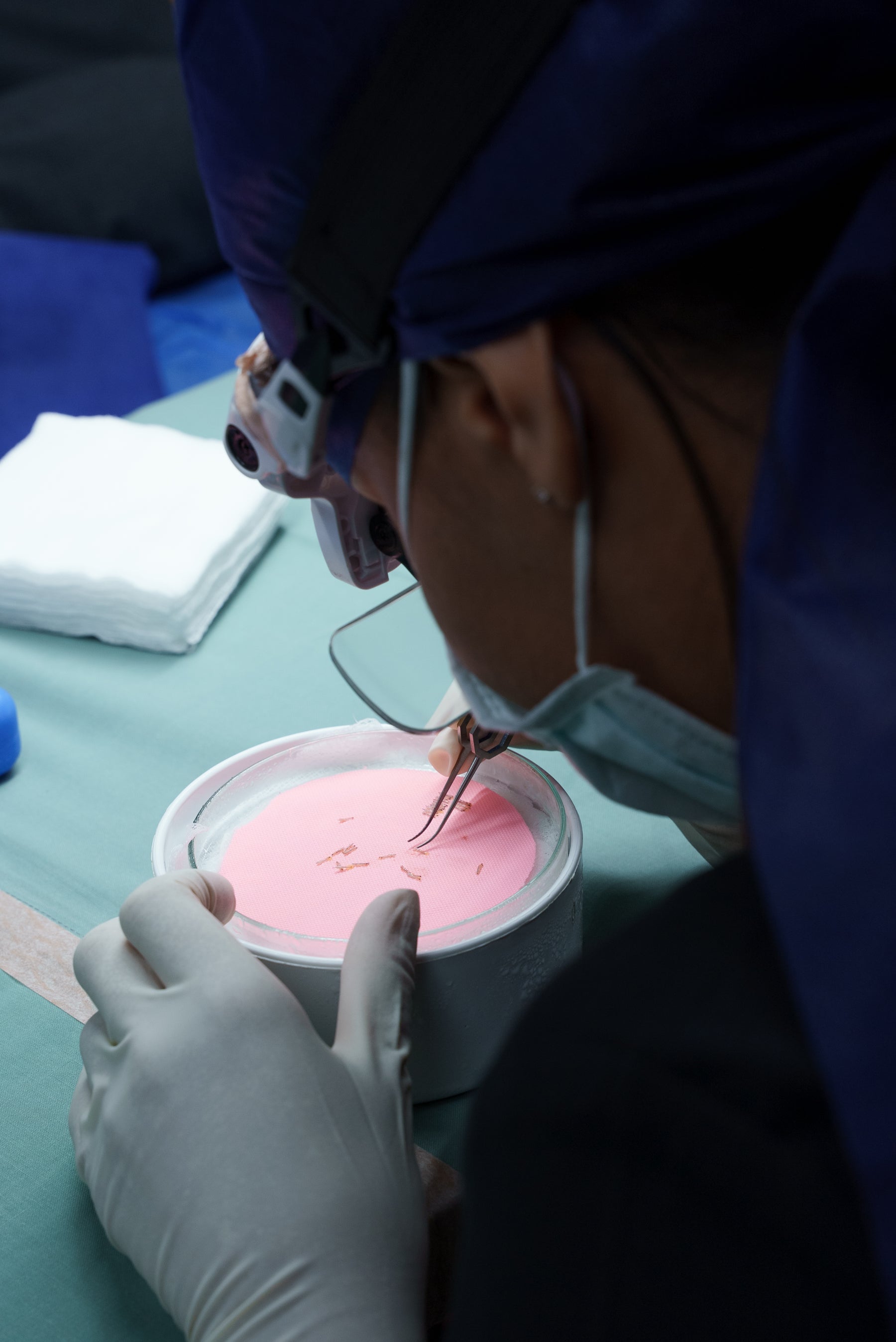 Hair Transplant Recovery